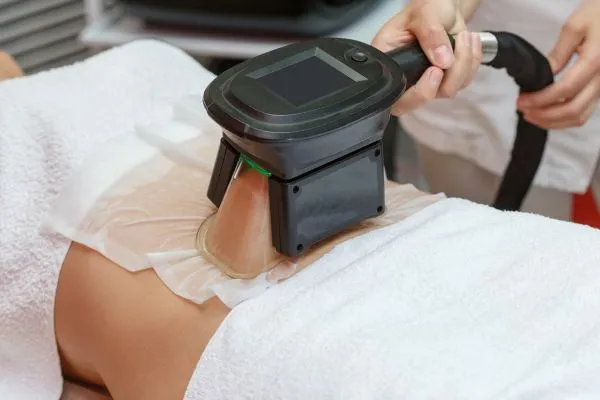 Image of person having fat freezing treatment to help weight gain Sandy