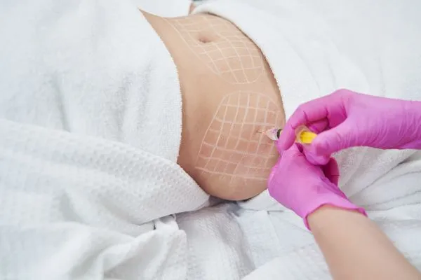 image of fat dissolving injections on love handles to help combat weight gain Sandy