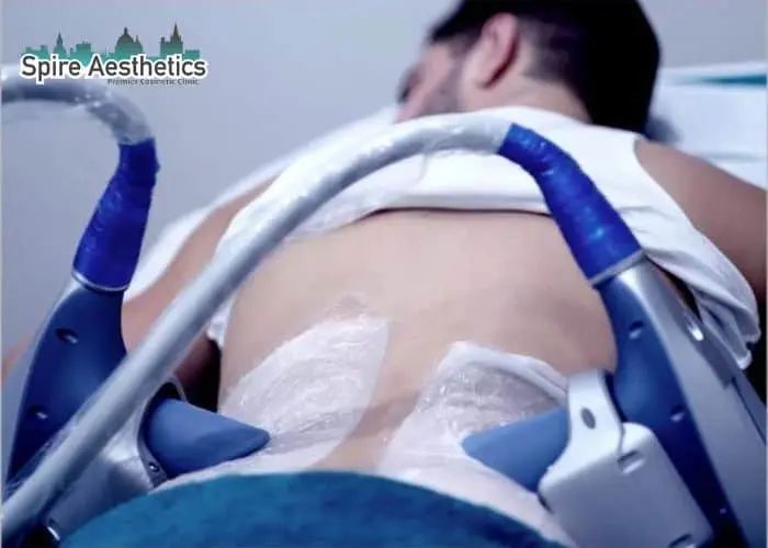 Man having fat freezing treatment done on love handles before a competitions Sandy to create a sculpted look.